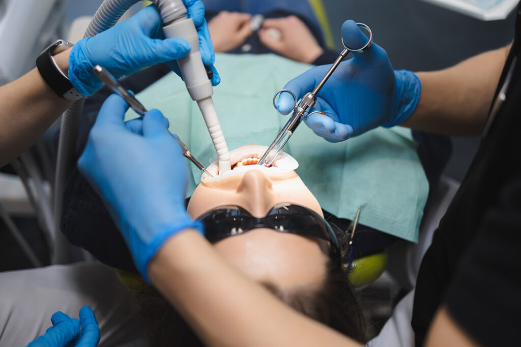 Frenillos Bucales en clinica Dental Borras en Peniscola