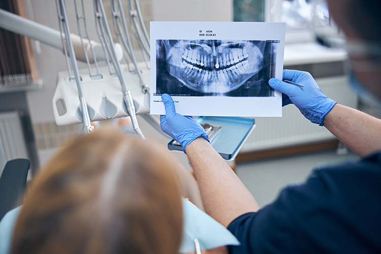 Dentista mostrando radiografía, quistes maxilares en Alcalà.